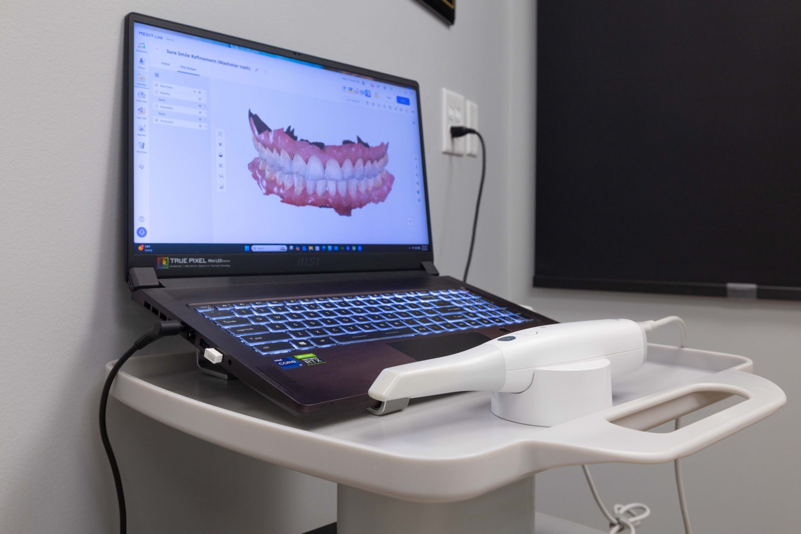 Intraoral scanner used for clear aligners at Metropolitan Dental Centre
